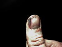 post-892-0-47625300-1333476611_thumb.jpg